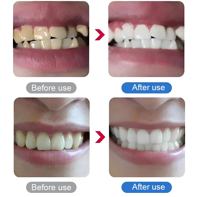 Detartreur dental elèctric d'ultraos