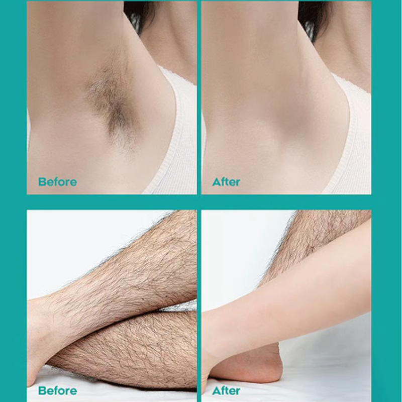 Crema depilatoria indolora para todo el cuerpo