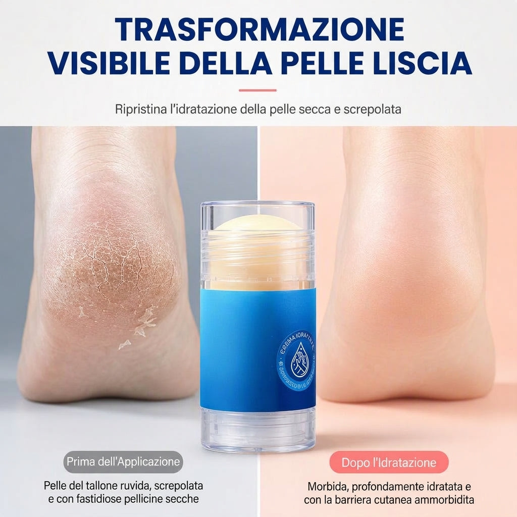 Stick balsamo idratante per mani, talloni e zone secche | Roumant®